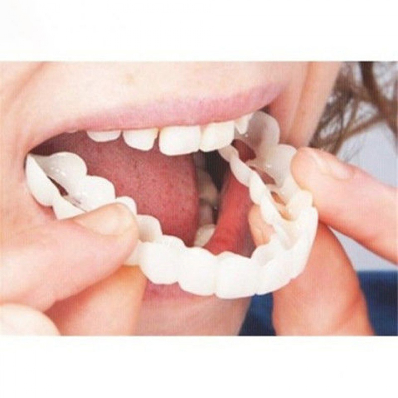 Teeth Whitening Veneers - Idealnie Dopasowane Nakładki na Zęby Wybielające