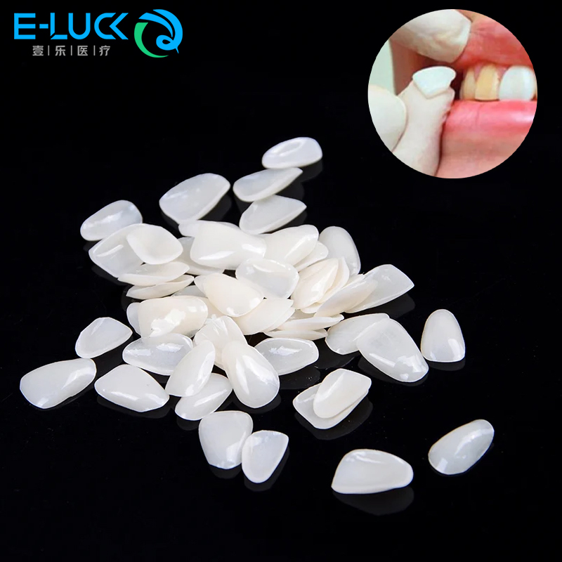 Teeth Whitening Veneers - 50 szt. Forniry na zęby dentystyczne