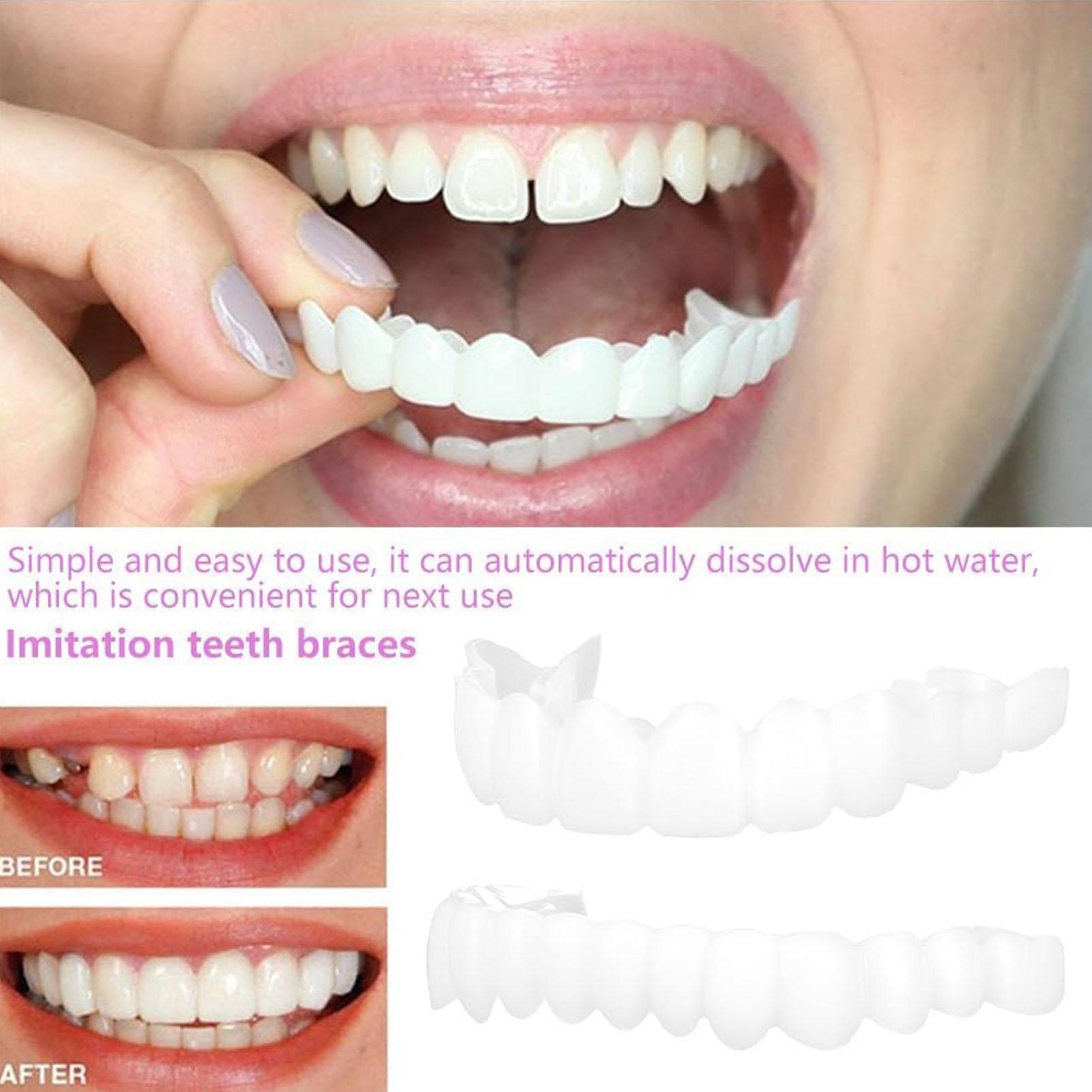 Teeth Whitening Veneers - 2 szt. Tymczasowe nakładki na zęby