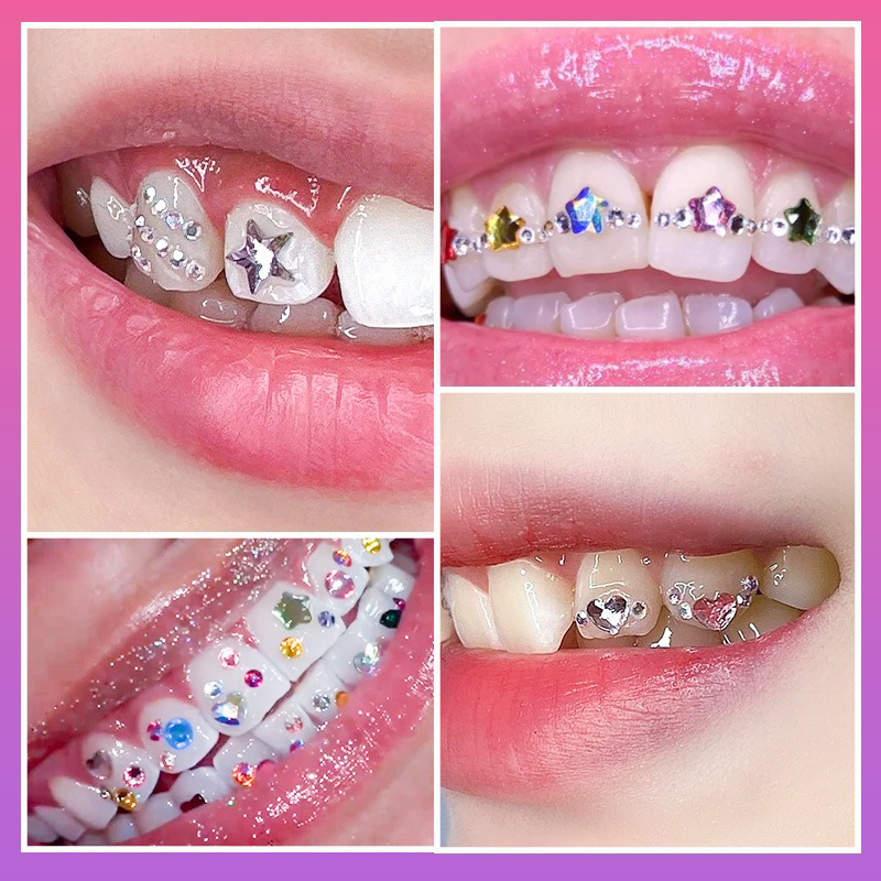 Nowy Profesjonalny Zestaw do O – Tooth Gem Kit recenzja i cena