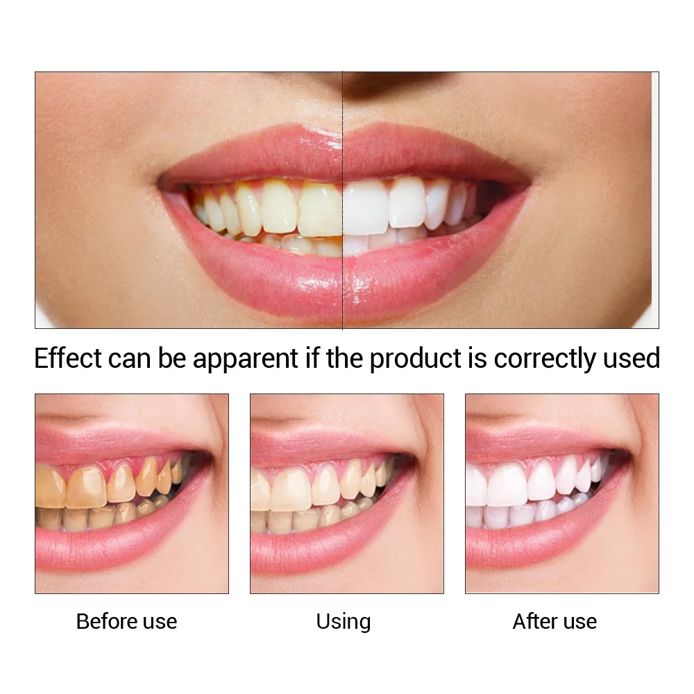 FTEENPLY esencja do wybielania – Teeth Whitening Session recenzja i cena