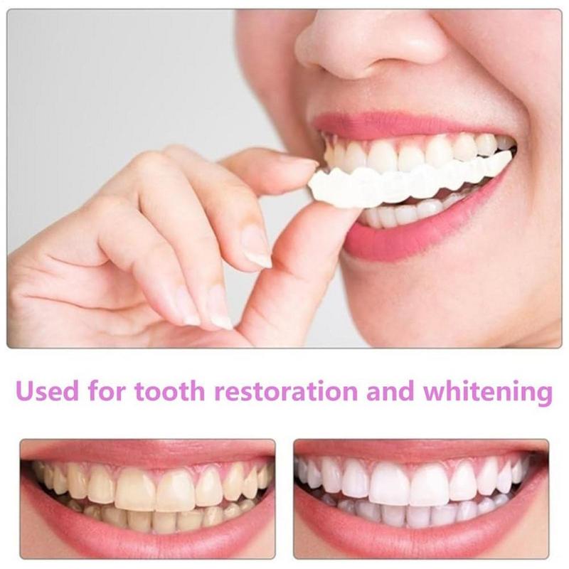 Okładziny na zęby do natychmia – Teeth Whitening Veneers recenzja i cena