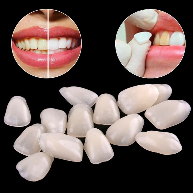 Tymczasowe licówki dentystyczn – Teeth Whitening Veneers recenzja i cena