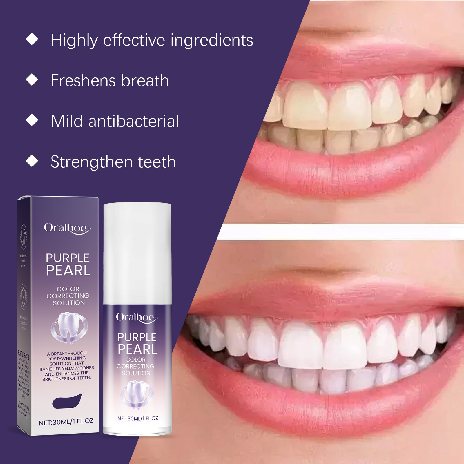 2026 Nowa fioletowa technologi – Teeth Whitening Mousse recenzja i cena