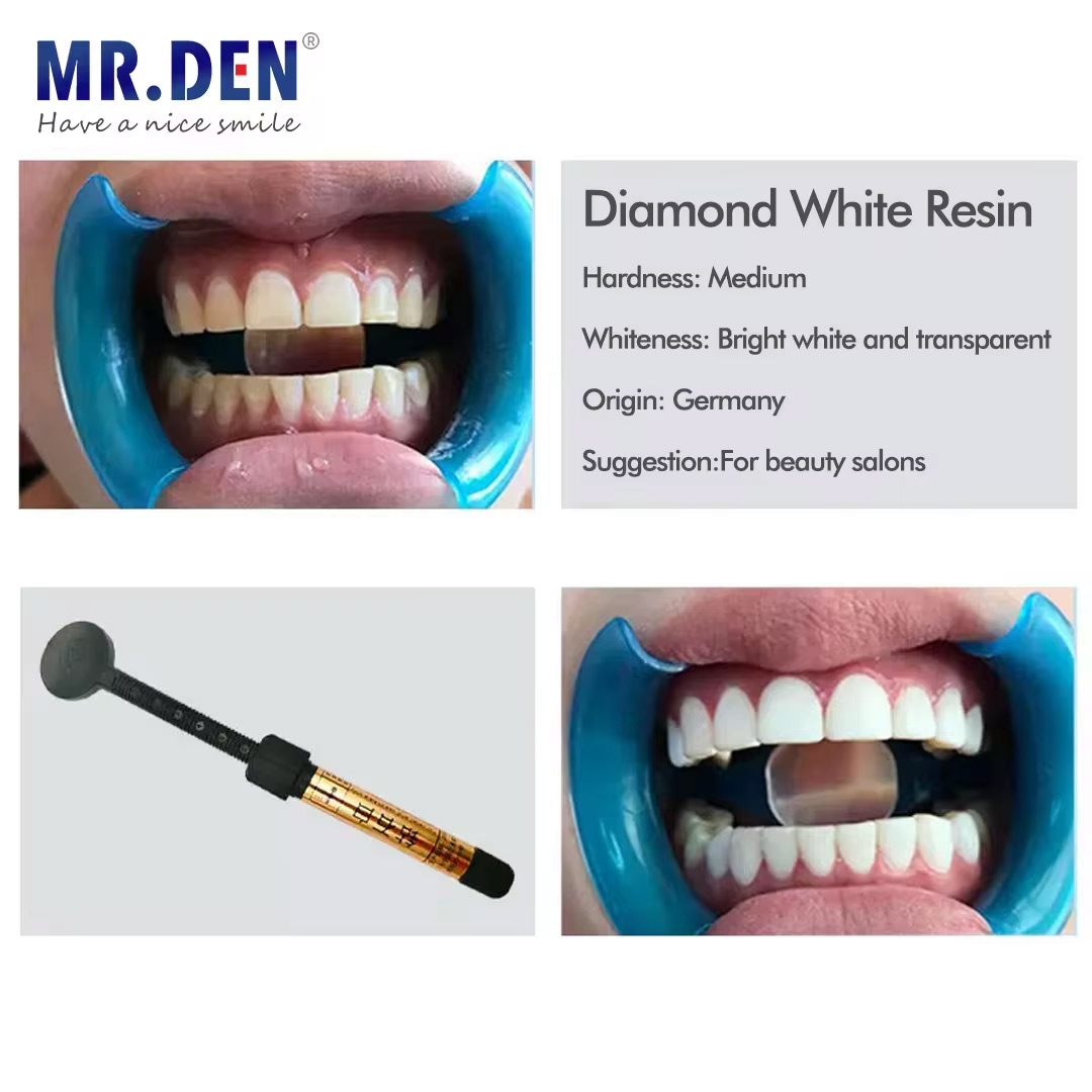 Materiał do licówek z nano-ema – Teeth Whitening Veneers recenzja i cena