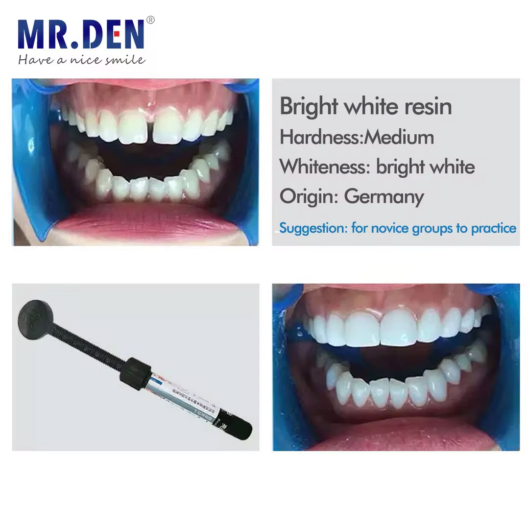 Materiał do licówek z nano-ema – Teeth Whitening Veneers recenzja i cena