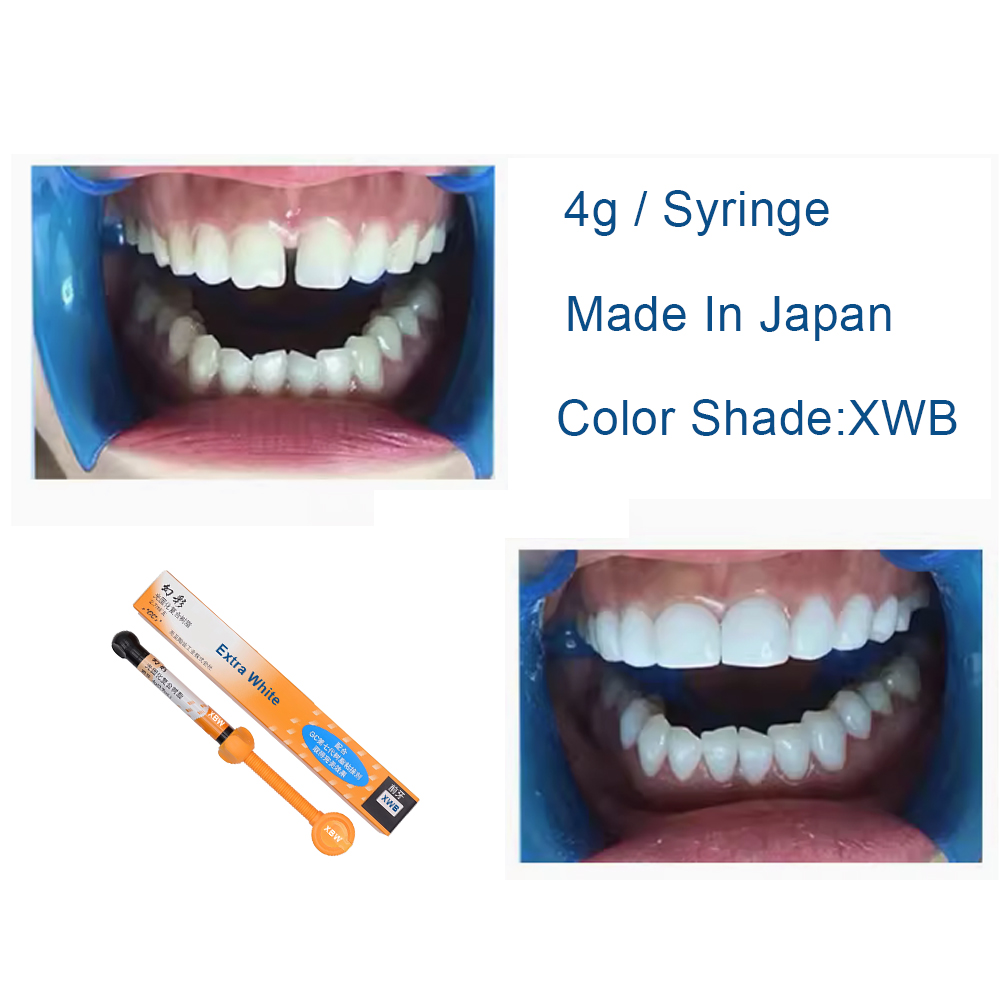 Kompozyt dentystyczny Extra Wh – Teeth Whitening Veneers recenzja i cena
