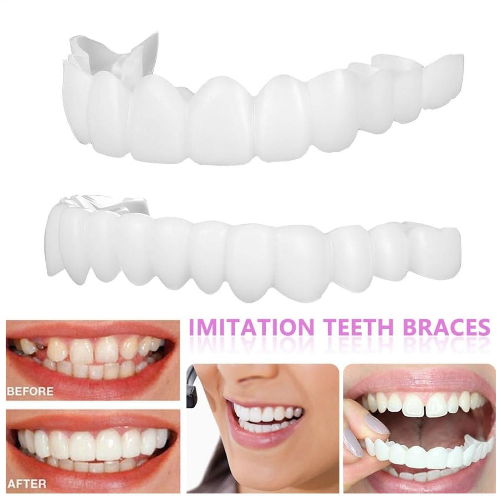 2 szt. Tymczasowe nakładki na  – Teeth Whitening Veneers recenzja i cena