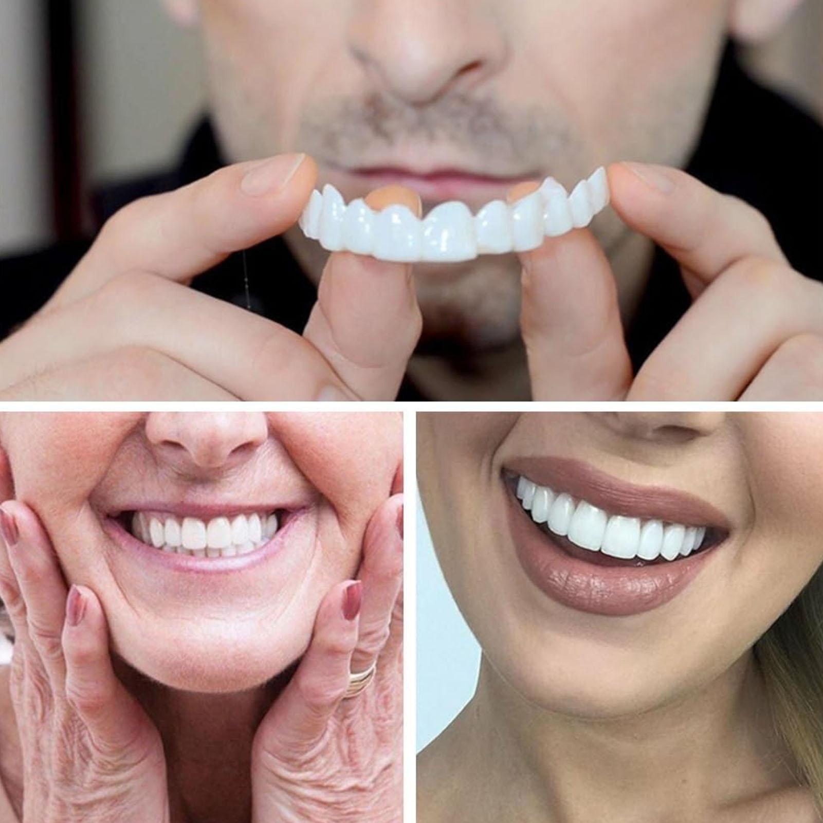 2 szt. Tymczasowe nakładki na  – Teeth Whitening Veneers recenzja i cena